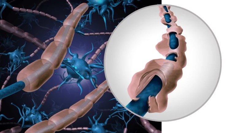 BCP inflammation benefits
